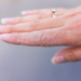 How to Treat Dry Skin Naturally: Tips That Actually Work