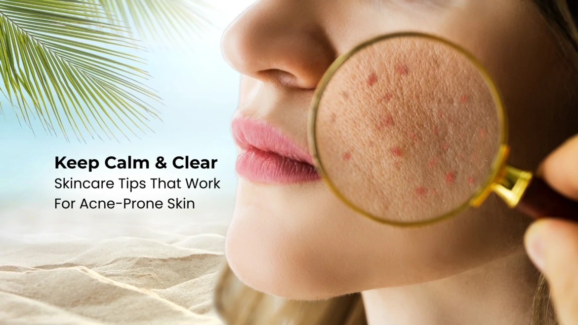 Acne-Prone Skin Care: Dos and Don’ts for Clearer Skin