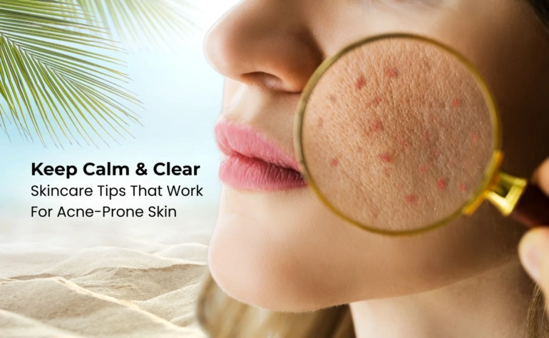 Acne-Prone Skin Care: Dos and Don’ts for Clearer Skin