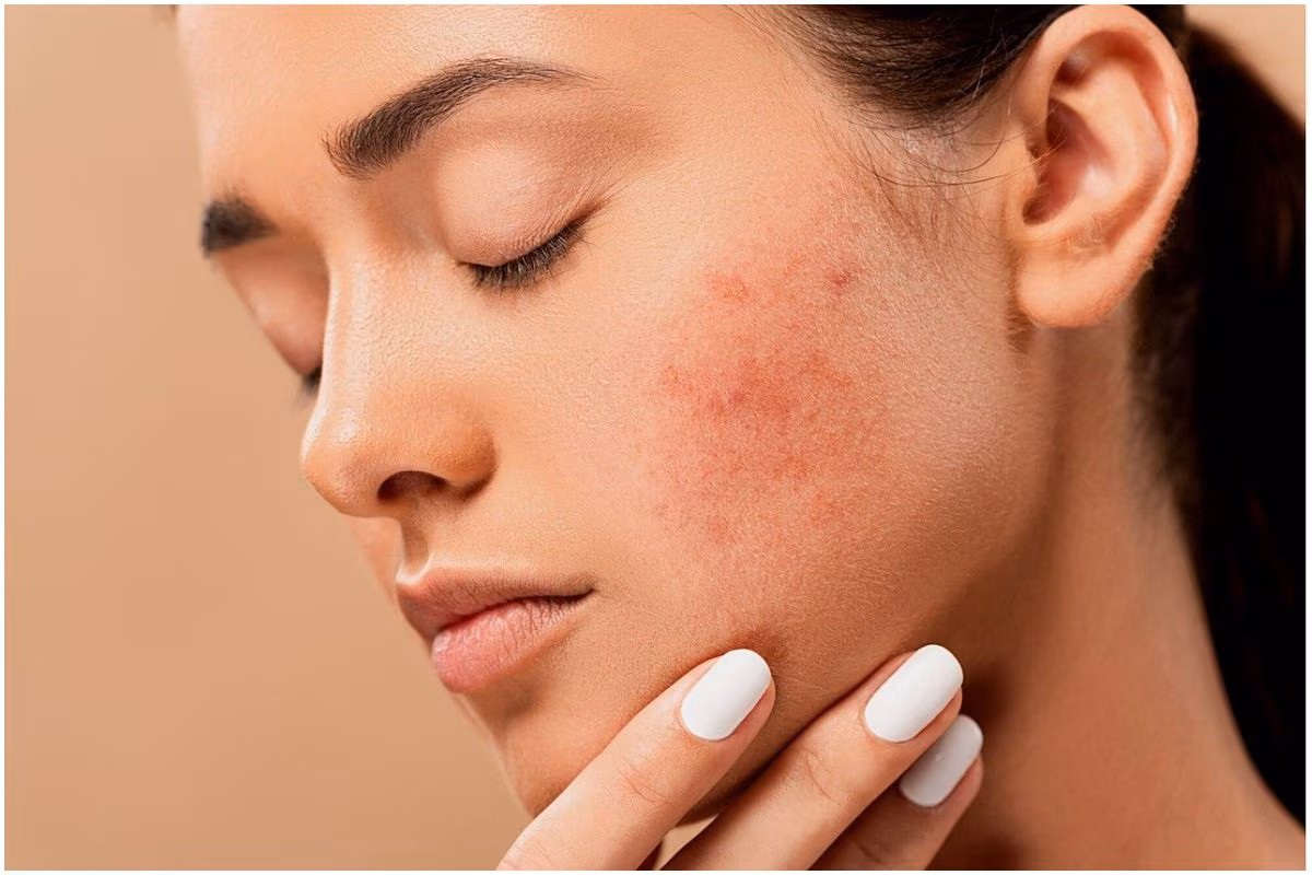 Common Skin Care Mistakes That Damage Your Skin and How to Fix Them