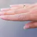 How to Treat Dry Skin Naturally: Tips That Actually Work